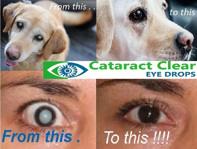 Cataract Clear 4% NAC XTRAMAX