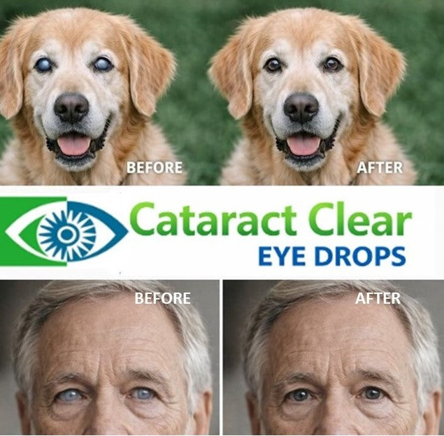 Cataract Clear 2% NAC ULTRA