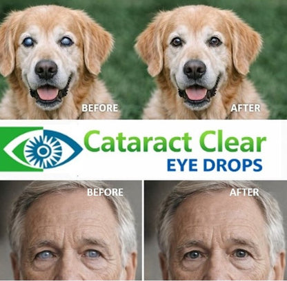 Cataract Clear 2% NAC ULTRA